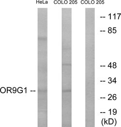 OR9G1 Polyclonal Antibody, Invitrogen 100 &mu;g; Unconjugated:Antibodies,