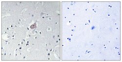 Phospho-c-Abl (Tyr393, Tyr412) Polyclonal Antibody, Invitrogen 100 &mu;g;
