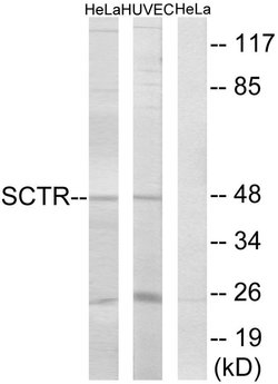 SCTR Polyclonal Antibody, Invitrogen 100 &mu;g; Unconjugated:Antibodies,