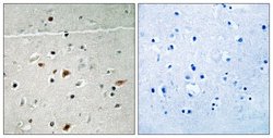 Phospho-LIMK2 (Ser283) Polyclonal Antibody, Invitrogen 100 μg; Unconjugated:Antibodies,