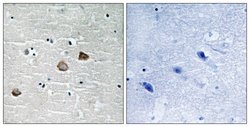 Phospho-CaMKII beta/gamma/delta (Thr287) Polyclonal Antibody, Invitrogen
