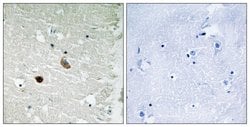 CaMKII beta/gamma/delta Polyclonal Antibody, Invitrogen 100 &mu;g; Unconjugated:Antibodies,