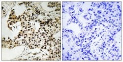 Phospho-PKR (Thr258) Polyclonal Antibody:Antibodies, Polyclonal