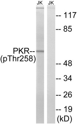 Phospho-PKR (Thr258) Polyclonal Antibody:Antibodies, Polyclonal