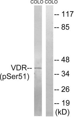Phospho-VDR (Ser51) Polyclonal Antibody, Invitrogen 100 &mu;g; Unconjugated:Antibodies,