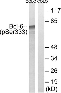 Phospho-Bcl-6 (Ser333) Polyclonal Antibody, Invitrogen 100 &mu;g; Unconjugated:Antibodies,