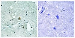 Phospho-IP3 Receptor 1 (Ser1764) Polyclonal Antibody, Invitrogen 100 &mu;g;