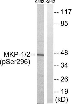 Phospho-MKP1/MKP2 (Ser296, Ser318) Polyclonal Antibody, Invitrogen 100