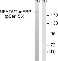 Phospho-NFAT5 (Ser155) Polyclonal Antibody, Invitrogen 100 &mu;g; Unconjugated:Antibodies,