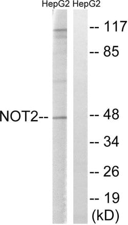 CNOT2 Polyclonal Antibody, Invitrogen 100 &mu;g; Unconjugated:Antibodies,