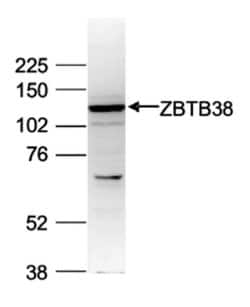Invitrogen ZBTB38 Polyclonal Antibody 100 &mu;L; Unconjugated:Antibodies,