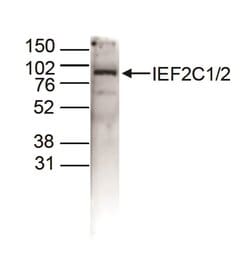 Invitrogen AGO1/AGO2 Polyclonal Antibody 100 &mu;L; Unconjugated:Antibodies,