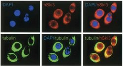 Invitrogen SKI3 Polyclonal Antibody 150 &mu;g | Buy Online | Invitrogen&trade; | Fisher Scientific