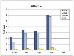 Invitrogen H2BK12ac Polyclonal Antibody 50 &mu;g; Unconjugated:Antibodies,