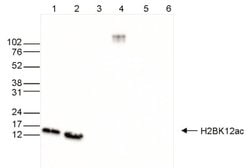Invitrogen H2BK12ac Polyclonal Antibody 50 &mu;g; Unconjugated:Antibodies,
