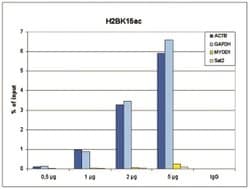 Invitrogen H2BK15ac Polyclonal Antibody 50 &mu;g; Unconjugated:Antibodies,