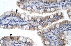 Invitrogen ZNF341 Polyclonal Antibody 100 &mu;L; Unconjugated:Antibodies,