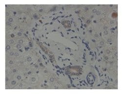Invitrogen GLIS2 Polyclonal Antibody 100 &mu;L; Unconjugated:Antibodies,