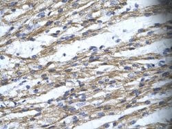 Invitrogen RBM10 Polyclonal Antibody 100 &mu;L; Unconjugated:Antibodies,