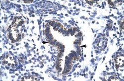 Invitrogen RBM10 Polyclonal Antibody 100 &mu;L; Unconjugated:Antibodies,