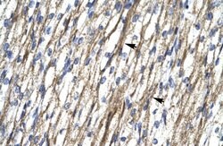 Invitrogen RBM10 Polyclonal Antibody 100 &mu;L; Unconjugated:Antibodies,