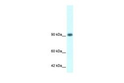 Invitrogen RBM10 Polyclonal Antibody 100 &mu;L; Unconjugated:Antibodies,