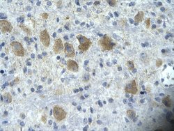 Invitrogen TAF15 Polyclonal Antibody 100 μL; Unconjugated:Antibodies,