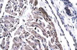 Invitrogen TAF15 Polyclonal Antibody 100 μL; Unconjugated:Antibodies,