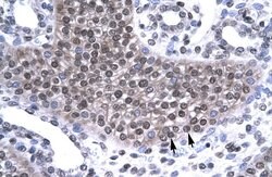Invitrogen TAF15 Polyclonal Antibody 100 μL; Unconjugated:Antibodies,