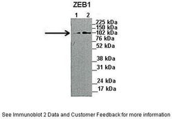 Invitrogen ZEB1 Polyclonal Antibody 100 &mu;L; Unconjugated:Antibodies,