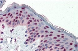 Invitrogen Fra1 Polyclonal Antibody 100 &mu;L; Unconjugated:Antibodies,