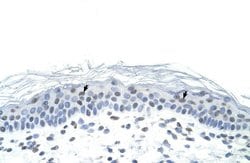 Invitrogen Fra1 Polyclonal Antibody 100 &mu;L; Unconjugated:Antibodies,