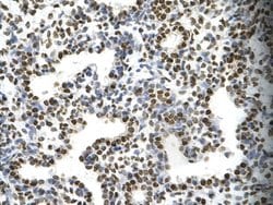 Invitrogen Fra1 Polyclonal Antibody 100 &mu;L; Unconjugated:Antibodies,
