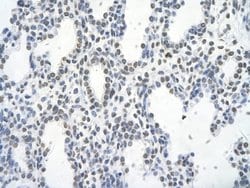 Invitrogen Fra1 Polyclonal Antibody 100 &mu;L; Unconjugated:Antibodies,