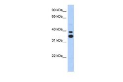 Invitrogen MSX2 Polyclonal Antibody 100 &mu;L | Buy Online | Invitrogen&trade; | Fisher Scientific