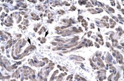 Invitrogen GTF2H3 Polyclonal Antibody 100 &mu;L; Unconjugated:Antibodies,