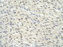 Invitrogen GTF2H3 Polyclonal Antibody 100 &mu;L; Unconjugated:Antibodies,