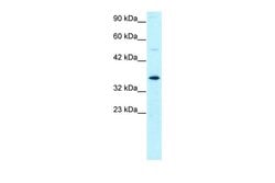 Invitrogen GTF2H3 Polyclonal Antibody 100 &mu;L; Unconjugated:Antibodies,