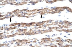 Invitrogen PQBP1 Polyclonal Antibody 100 &mu;L; Unconjugated:Antibodies,