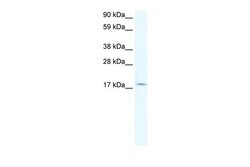 Invitrogen PQBP1 Polyclonal Antibody 100 &mu;L; Unconjugated:Antibodies,