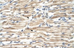Invitrogen YAF2 Polyclonal Antibody 100 &mu;L; Unconjugated:Anticuerpos