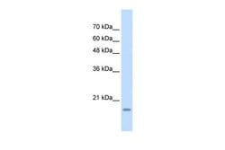 Invitrogen YAF2 Polyclonal Antibody 100 &mu;L; Unconjugated:Anticuerpos