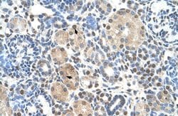 Invitrogen ZNF274 Polyclonal Antibody 100 &mu;L; Unconjugated:Antibodies,