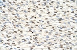 Invitrogen ZNF274 Polyclonal Antibody 100 &mu;L; Unconjugated:Antibodies,