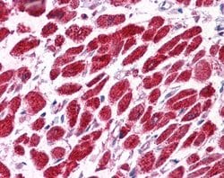 Invitrogen EAP30 Polyclonal Antibody 100 &mu;L; Unconjugated:Antibodies,