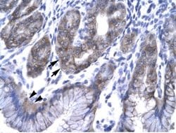 Invitrogen EAP30 Polyclonal Antibody 100 &mu;L; Unconjugated:Antibodies,