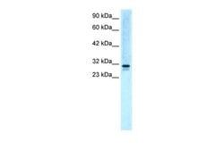 Invitrogen EAP30 Polyclonal Antibody 100 &mu;L; Unconjugated:Antibodies,