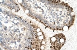 Invitrogen ZFP1 Polyclonal Antibody 100 &mu;L; Unconjugated:Antibodies,