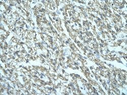 Invitrogen FGD1 Polyclonal Antibody 100 &mu;L; Unconjugated:Antibodies,