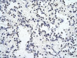 Invitrogen ZNF652 Polyclonal Antibody 100 &mu;L; Unconjugated:Antibodies,